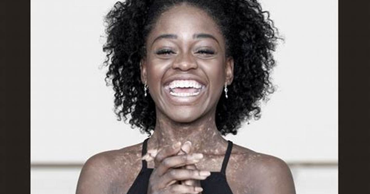 Michaela Deprince Net Worth