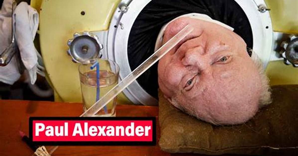 Paul Alexander Net Worth